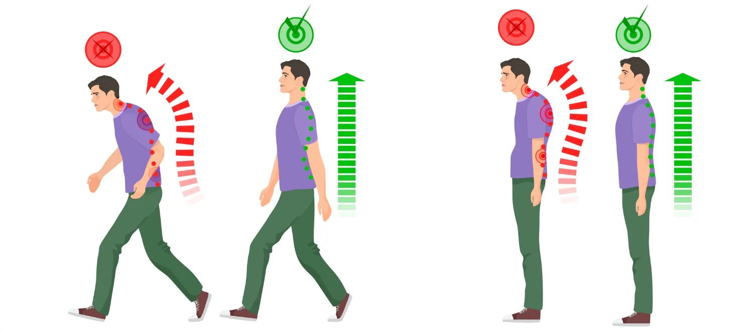 The Benefits of Correct Posture: Why It Matters for Your Health and Productivity
